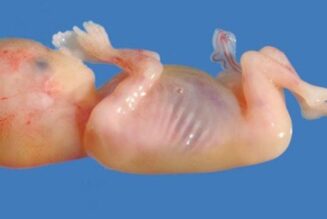 Des bébés morts transformés en “médicament”